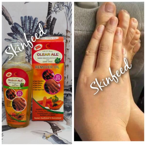 clear all dark knuckles clear & dark spot remover oil +  Carrot,Papaya,Turmeric