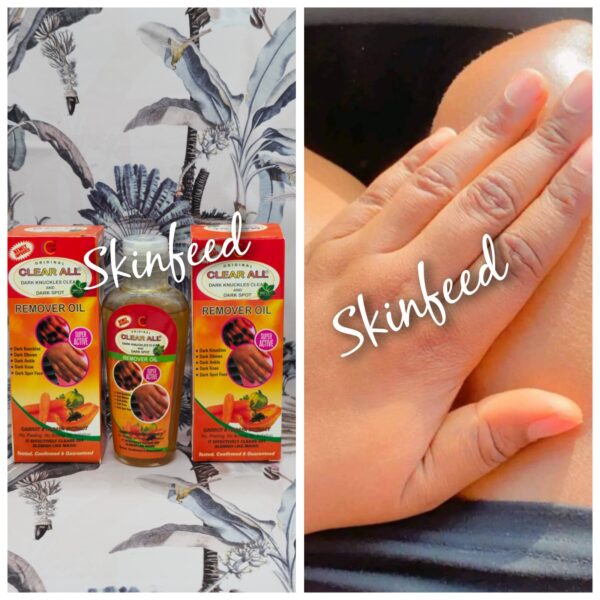 clear all dark knuckles clear & dark spot remover oil +  Carrot,Papaya,Turmeric