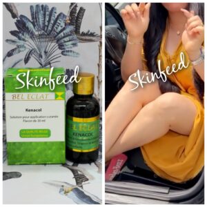 10-1552.jpg Bel Eclat Eclat Kenacol Oil. 30ml X 1. For Promixing. X 1. Exp. 2028