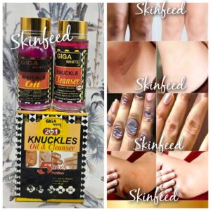 2 In 1 Oil & Cleanser Knuckle Remover.Anti Dark Spots. 100ml