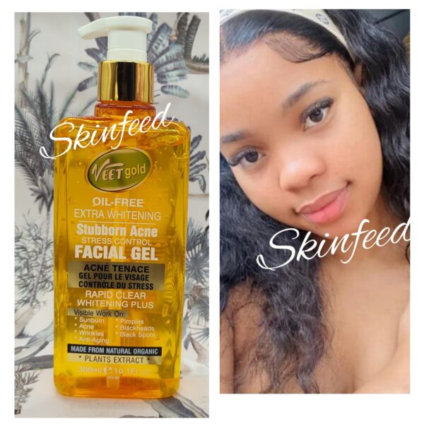 VeetGold Oil Free Whitening  Acne & Stress  Control Facial Gel 300ml X 1 💯%💪
