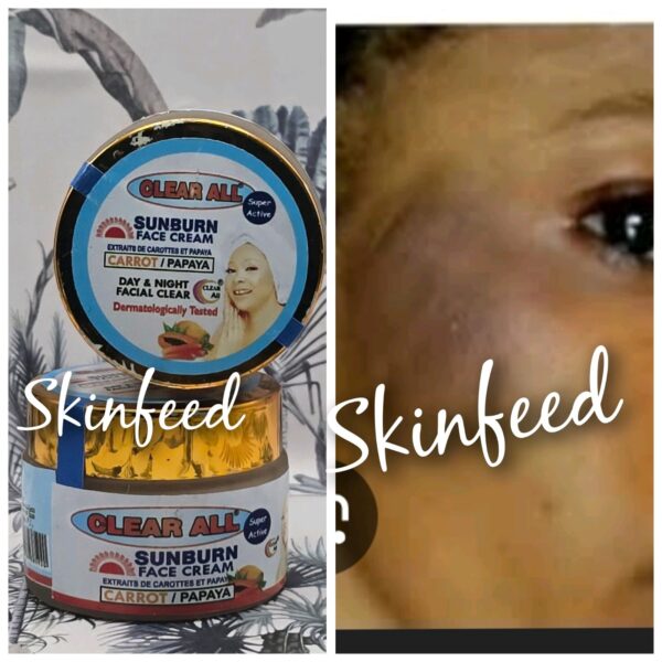 X2. Clear All Sun Burn Day & Night Face Cream. 50g X 2 NOT FOR SENSITIVE skin.