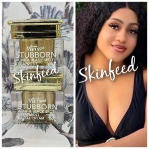 Skinfeed Vectgold Stubborn Acne & Black Spot Treatment Facial Cream (30g)