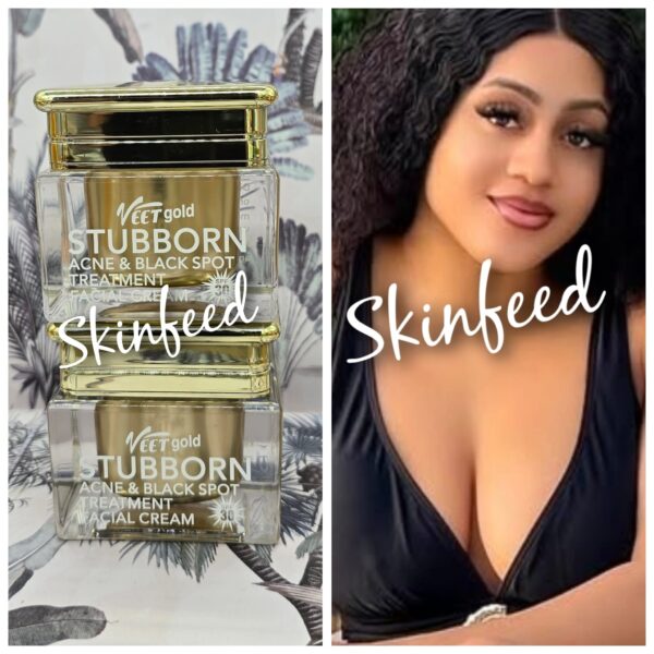 Skinfeed Vectgold Stubborn Acne & Black Spot Treatment Facial Cream (30g) Skinfeed Vectgold Stubborn Acne & Black Spot Treatment Facial Cream (30g)