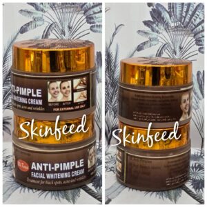 Skinfeed Anti-Pimple Facial Whitening Cream – Treatment for Black Spots, Acne & Wrinkles (30g)